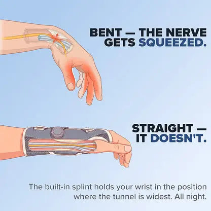 Talvionix Brace