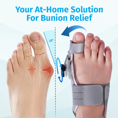 Bunion Correcter