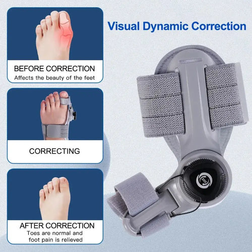 Bunion Correcter
